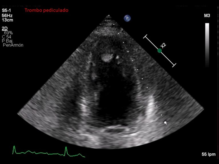 Diapositiva8