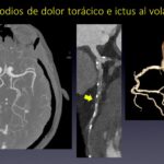 Diapositiva9