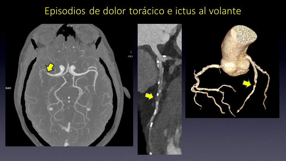 Diapositiva9