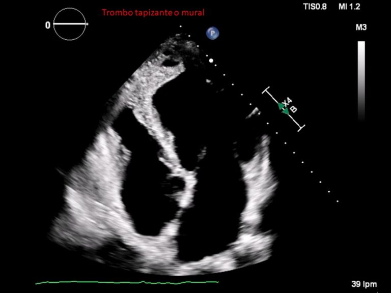 Diapositiva9
